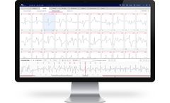 AT-Report - AI-Based Accurate ECG Analysis Software