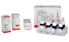 Aglutinin Negative