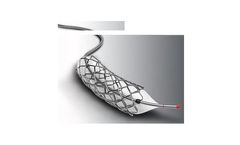 Confluent Medical - Balloon Catheters