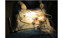 Ceatec - Model MAXOP - Interdisciplinary Surgical Retractor System
