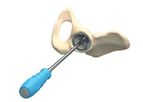 EasyHip - Model E-688 - Cementless Cup