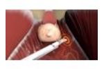 ProPep Surgical - Nerve Monitoring Animation - Video