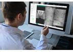 Intellijoint VIEW - Web-Based Surgical Planning Solution
