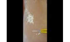Kogent Surgical Focused Forceps vs "Yellow" Forceps - Video