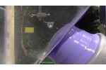 Medispec ESWL Stone Fragmentation - Video