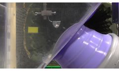 Medispec ESWL Stone Fragmentation - Video