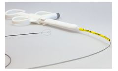 endox - Tipless Nitinol Stone Extractor