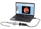 Optim ENTity - Mobile FEES System for Voice & Swallowing Diagnostics