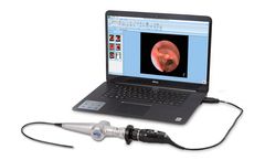 Optim ENTity - Mobile FEES System for Voice & Swallowing Diagnostics