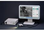 Model Fluobeam Lx - The Ultimate Camera for Monitoring In Parathyroid Surgery