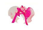 My3D - Image Processors Segment CT Scans