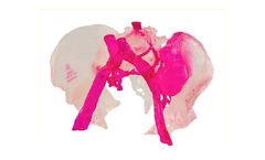 My3D - Image Processors Segment CT Scans