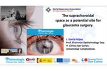 The suprachoroidal space as a potential site for glaucoma surgery - Video