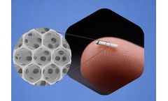 Micro-Invasive Glaucoma Surgery Device (MIGS) for  Glaucoma Treatment