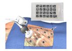 Clear Guide VisiMARKERS - Model I & II - Sterile on-patient Markers
