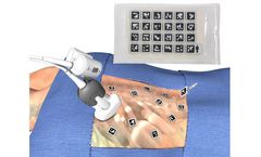 Clear Guide VisiMARKERS - Model I & II - Sterile on-patient Markers