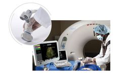 Clear Guide SteriMASK - Sterile Cover for SuperPROBE