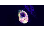 RMS - ILC Cell Therapy Candidate Kit
