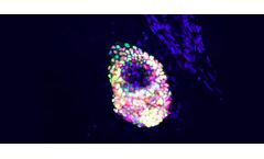 RMS - ILC Cell Therapy Candidate Kit