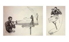 MirSense - Photoacoustic Spectroscopy Technology