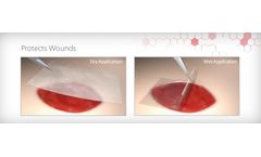 BIOSKIN - Amniotic Wound Matrix