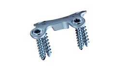 DARCO - Modular Forefoot System (MFS) Bow Plate