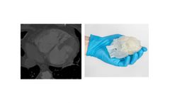 Axial3d - Solution for Cardiac Surgery