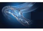 Tryton - Side Branch Stent