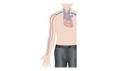 Amplifi - Vein Dilation System