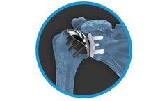 Archer - Model CSR - Total Shoulder System