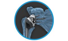 Archer - Model R1 - Reverse Shoulder System