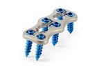 GammaTRACER Spider - Anterior Cervical Plate and Screws