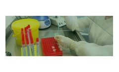 HiberGene - Model LAMP and RT-LAMP - Nucleic Acid Amplification Test (NAAT) Kit