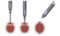 Tyber - Snap-Off Screws