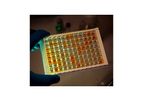 Kephera - Rapid Testing Tools for Chagas Disease