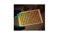Kephera - Rapid Testing Tools for Chagas Disease