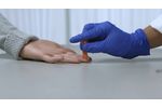 ADEXUSDx COVID-19 Antibody Test - Video