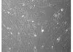 Vitro - Human Lung Adenocarcinoma Cancer Associated Fibroblasts: 1,000,000 Cells Per Vial