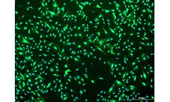 Vitro - Human Prostate Cancer Associated Fibroblasts: 1,000,000 Cells Per Vial