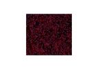 Vitro - Model SC00A5 - Human Pancreatic Fibroblasts: 500,000 Cells Per Vial