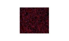 Vitro - Model SC00A5 - Human Pancreatic Fibroblasts: 500,000 Cells Per Vial