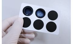 Agglutination Assays for Syphilis, Febrile Antigens (WIDAL)