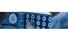 Cortical Disarray Measurement Technology