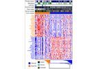 GeneCentric - Pancreatic Cancer Subtype Profiler (PurIST)