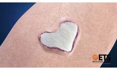 MIRRAGEN Advanced Wound Matrix - Video