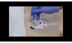 ETS MIRRAGEN Sacral Wound - Video