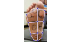 VisionQuest Abstract on Diabetic Peripheral Neuropathy Accepted by ADA