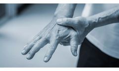 Stem Cell Therapy for Arthritis