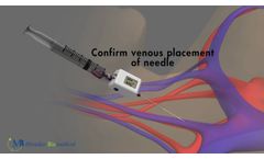 Compass Vascular Access - Video