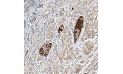 Bioporto - Model ABS 001-07 - Anti-APC-80-AAT Complexes, Neoepitope (Human) Mouse Monoclonal Antibody